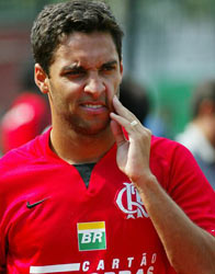 Ibson com cara de quem levou uma trombada no rachão.